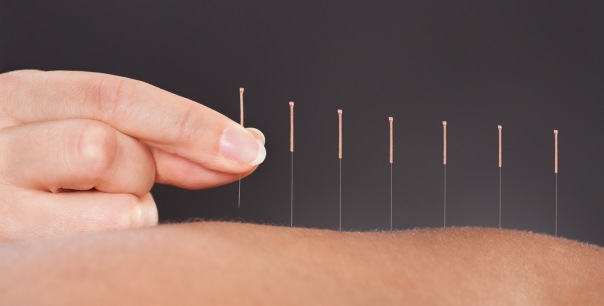 Holistic-Approach-with-Acupuncture1.jpg